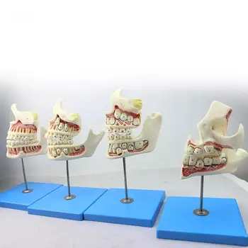 Conjunto De Desenvolvimento Humano Estágio De Decíduos E Permanentes Dentes Na Cavidade Oral Dentista Cirurgião Dentista Modelo De Ensino Médico Modelos